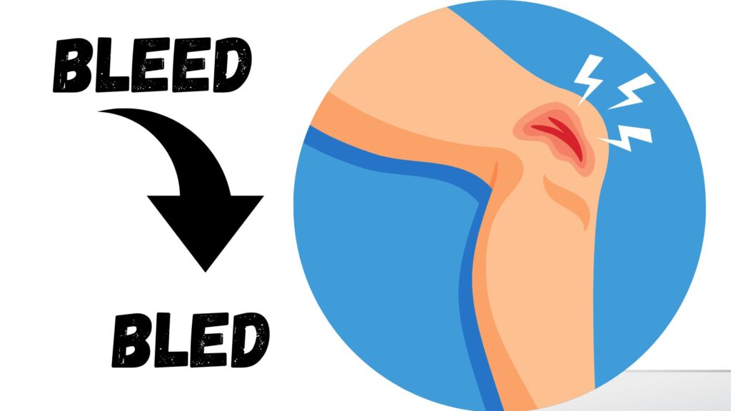 Past Tense of Bleed